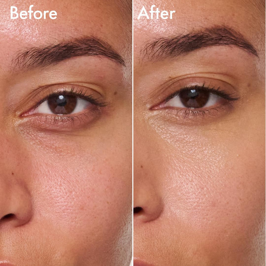 Catrice | Under Eye Brightener | Conceal & Brighten Dark Circles | With Hyaluronic Acid & Shea Butter | Vegan, Cruelty Free & Paraben Free (010 | Light Rose) - 7DAY'S