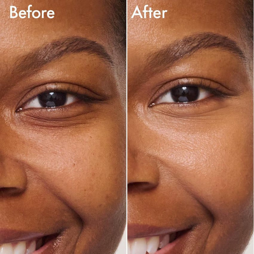 Catrice | Under Eye Brightener | Conceal & Brighten Dark Circles | With Hyaluronic Acid & Shea Butter | Vegan, Cruelty Free & Paraben Free (010 | Light Rose) - 7DAY'S