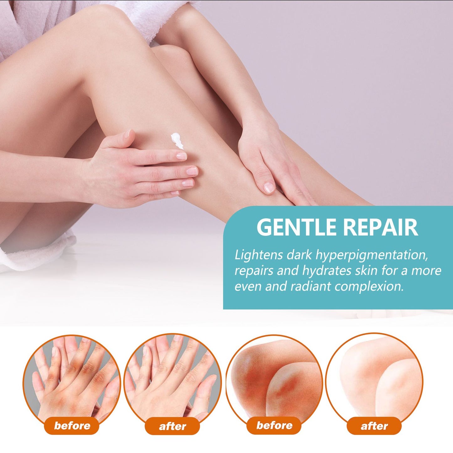 EELHOE Black Acanthoderm Cream Underarm Arm Knee Joint Black Moisturizing Care Cream