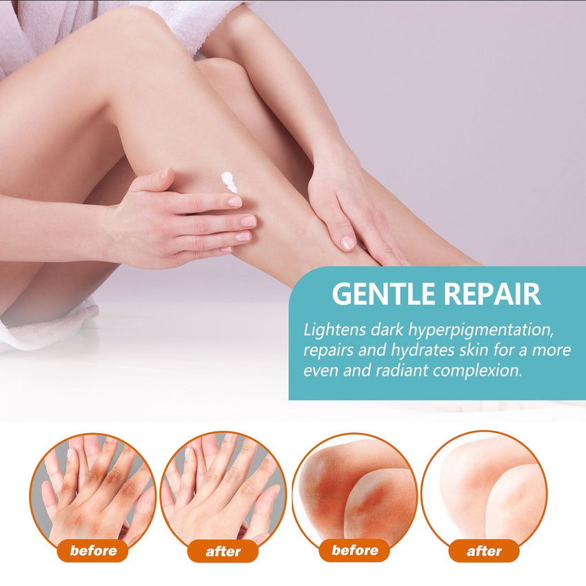 EELHOE Black Acanthoderm Cream Underarm Arm Knee Joint Black Moisturizing Care Cream