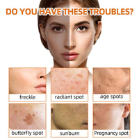 West&Month Turmeric Face Soap, Face Gentle Cleansing, Fade Spots And Smooth Fine Lines Cleaner Soap