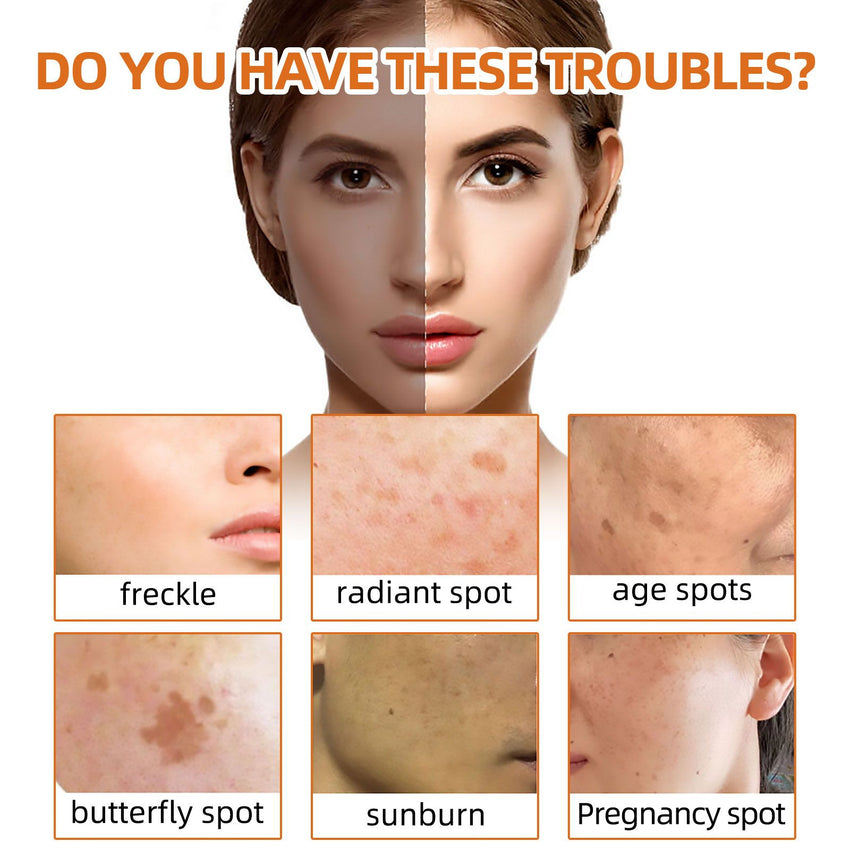 West&Month Turmeric Face Soap, Face Gentle Cleansing, Fade Spots And Smooth Fine Lines Cleaner Soap