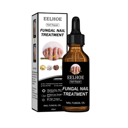 EELHOE Nail Solution Thickening And Brightening Nails Removing Gray Nail Nourishing Nail Care Solution