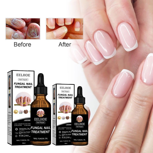 EELHOE Nail Solution Thickening And Brightening Nails Removing Gray Nail Nourishing Nail Care Solution