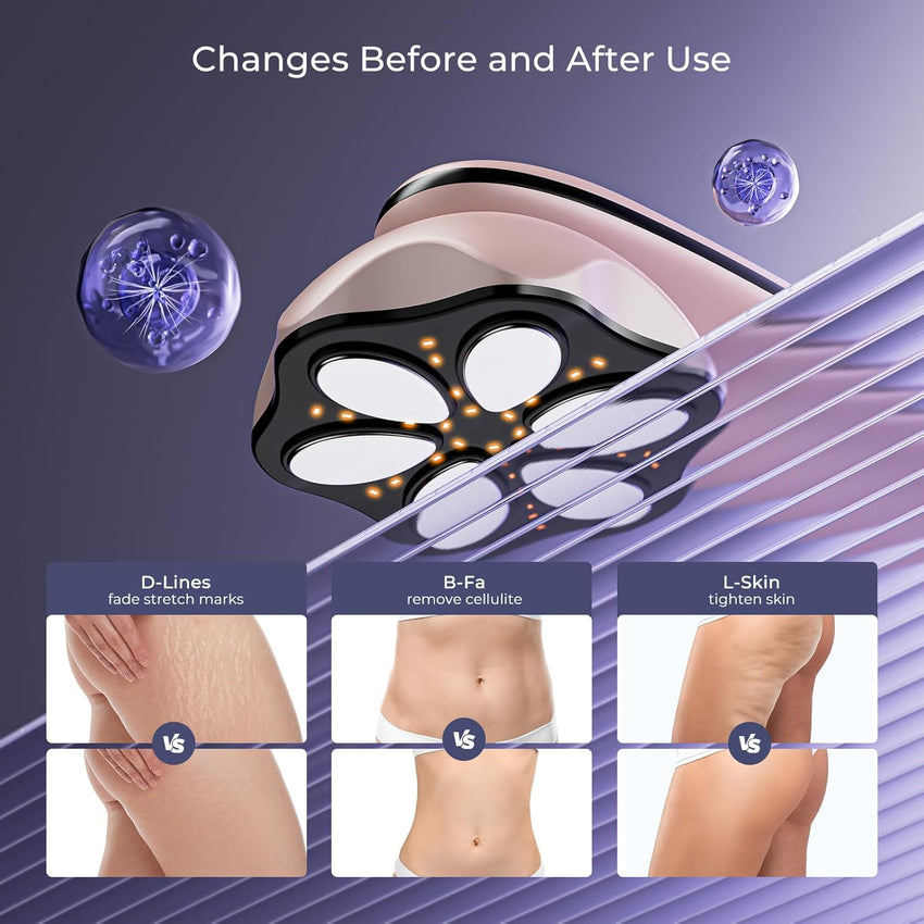 Depsoul Body Massager Professional Electric Leg Massager for Belly, Back, Waist, Arms, Buttocks - 7DAY'S