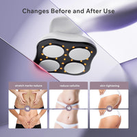 Depsoul Cellulite Massager Body Machine - 3 Modes 10 Levels with Heating Function Electric Massage Machine Body for Leg, Arm, Belly, Waist, Buttocks, Back - 7DAY'S