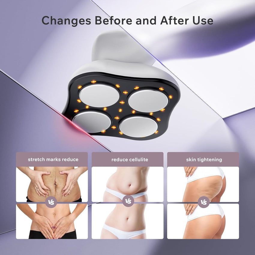 Depsoul Cellulite Massager Body Machine - 3 Modes 10 Levels with Heating Function Electric Massage Machine Body for Leg, Arm, Belly, Waist, Buttocks, Back - 7DAY'S