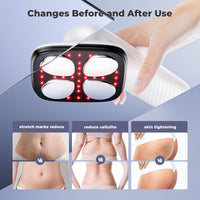 Depsoul Cellulite Massager for Women Handheld Body Massager - Cordless Massager for Belly, Arm, Waist, Leg, Butt, Back, White - 4g9722 - 7DAY'S