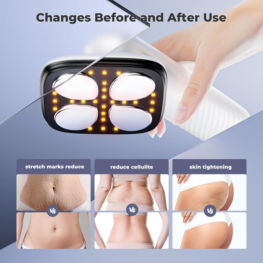 Depsoul Cellulite Massager for Women Handheld Body Massager - Cordless Massager for Belly, Arm, Waist, Leg, Butt, Back, White - 4g9722 - 7DAY'S