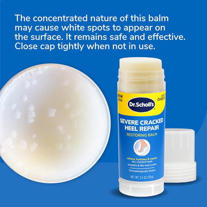 Dr. Scholl's Severe Cracked Heel Repair Restoring Balm 2.5oz, with 25% Urea for Dry, Cracked Feet, Heals and Moisturizes for Healthy Feet - 7DAY'S
