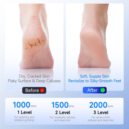 Cross-border popular electric foot callus remover, automatic and efficient foot file for removing dead skin, Amazon best-selling foot care tool