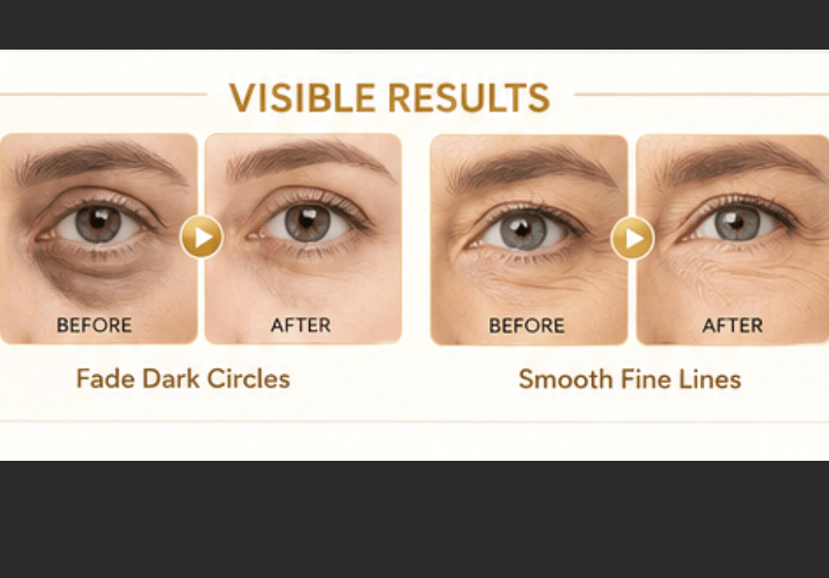 24K Gold Collagen Eye Masks, 60PCS Under Eye Patches with Hyaluronic Acid, for Dark Circles & Puffiness