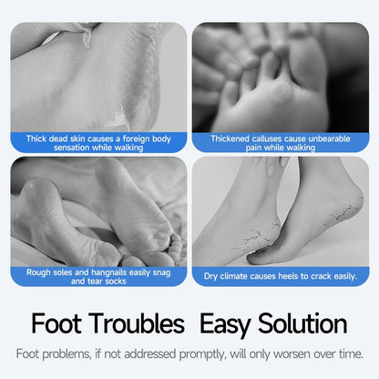 Cross-border popular electric foot callus remover, automatic and efficient foot file for removing dead skin, Amazon best-selling foot care tool