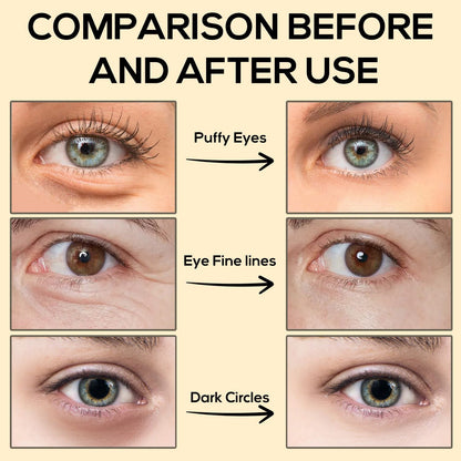 Golden Peptide Collagen Eye Mask, Moisturizing Eye Patches for Puffy Eyes and Dark Circles, 60PCS Hydrating Skincare