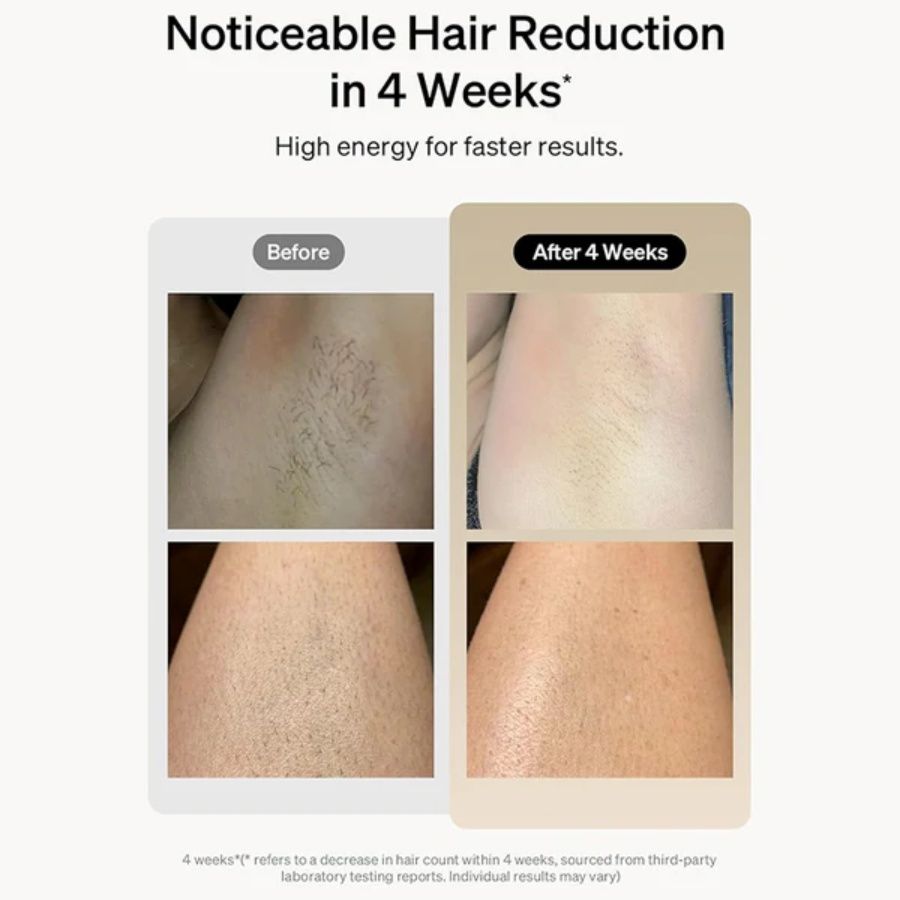 IPL Hair Removal 3 in 1 Permanent Painless Epilator 900,000 Flashes and 5 Energy Gears Laser Hair Remover Electric Epilator with Touch LCD for Body, Face, Underarms and Bikini Line