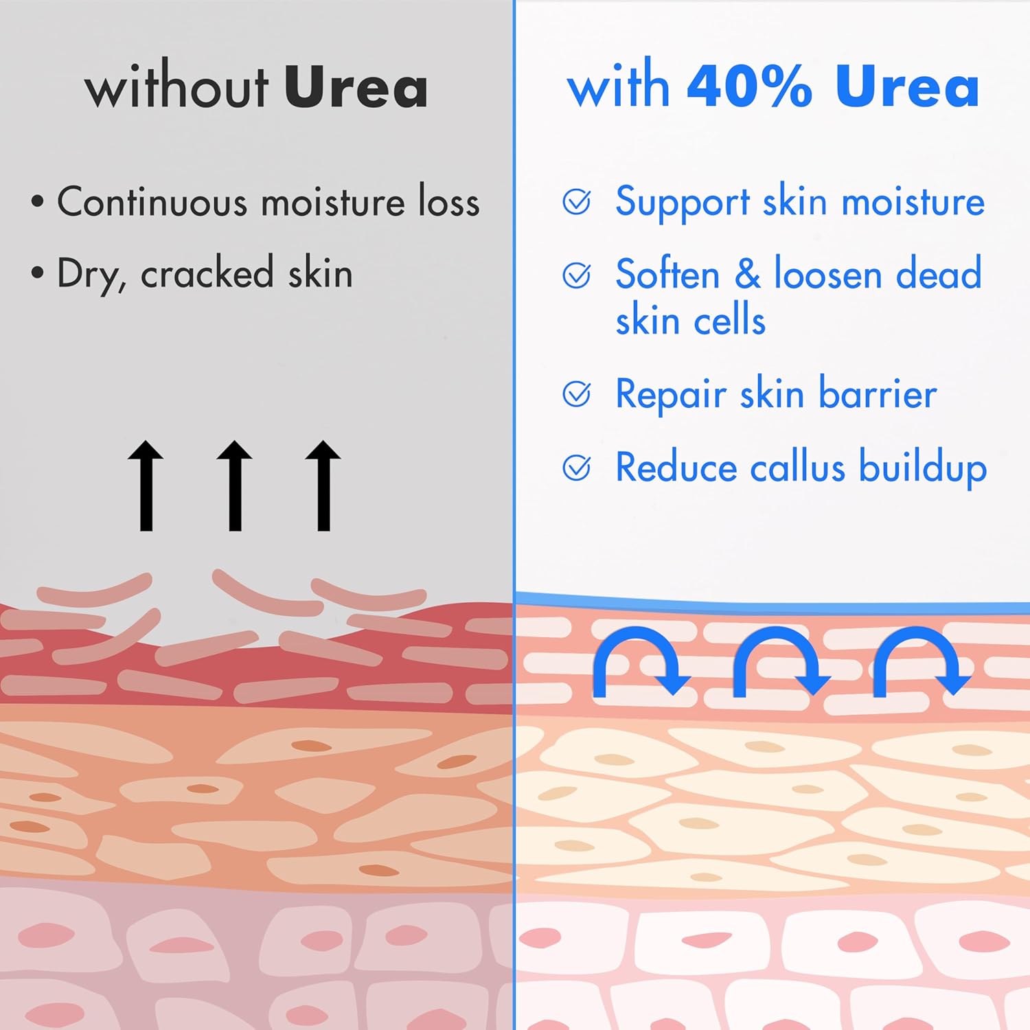 Ebanel Urea Cream 40% plus Salicylic Acid 2%, Foot Cream for Dry Cracked Heels Feet Knees Elbows Hands, Foot Dead Skin Cuticle Callus Remover Toenail Softener, Keratolytic Skin Barrier Repair - 7DAY'S