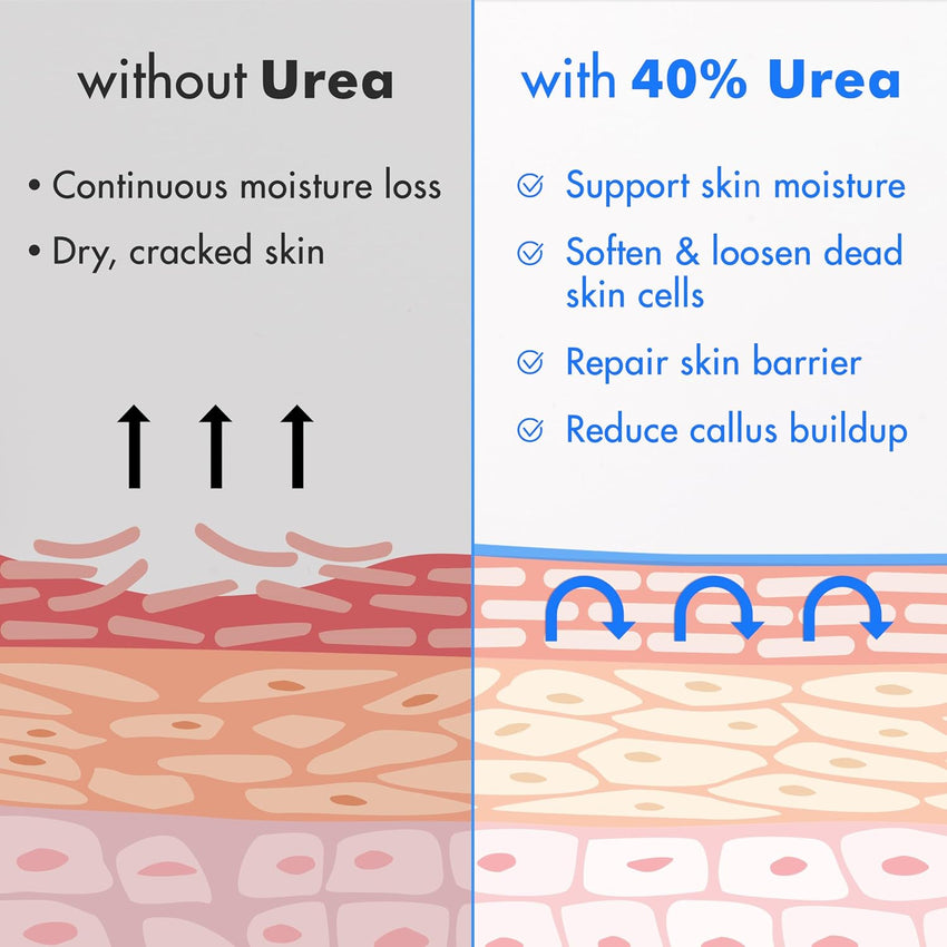 Ebanel Urea Cream 40% plus Salicylic Acid 2%, Foot Cream for Dry Cracked Heels Feet Knees Elbows Hands, Foot Dead Skin Cuticle Callus Remover Toenail Softener, Keratolytic Skin Barrier Repair - 7DAY'S