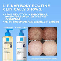 La Roche - Posay Lipikar AP+ Triple Repair Moisturizing Cream | Face & Body Lotion For Dry Skin | Shea Butter & Niacinamide Moisturizer | Gentle Face & Body Cream For Dry, Rough & Sensitive Skin - 7DAY'S