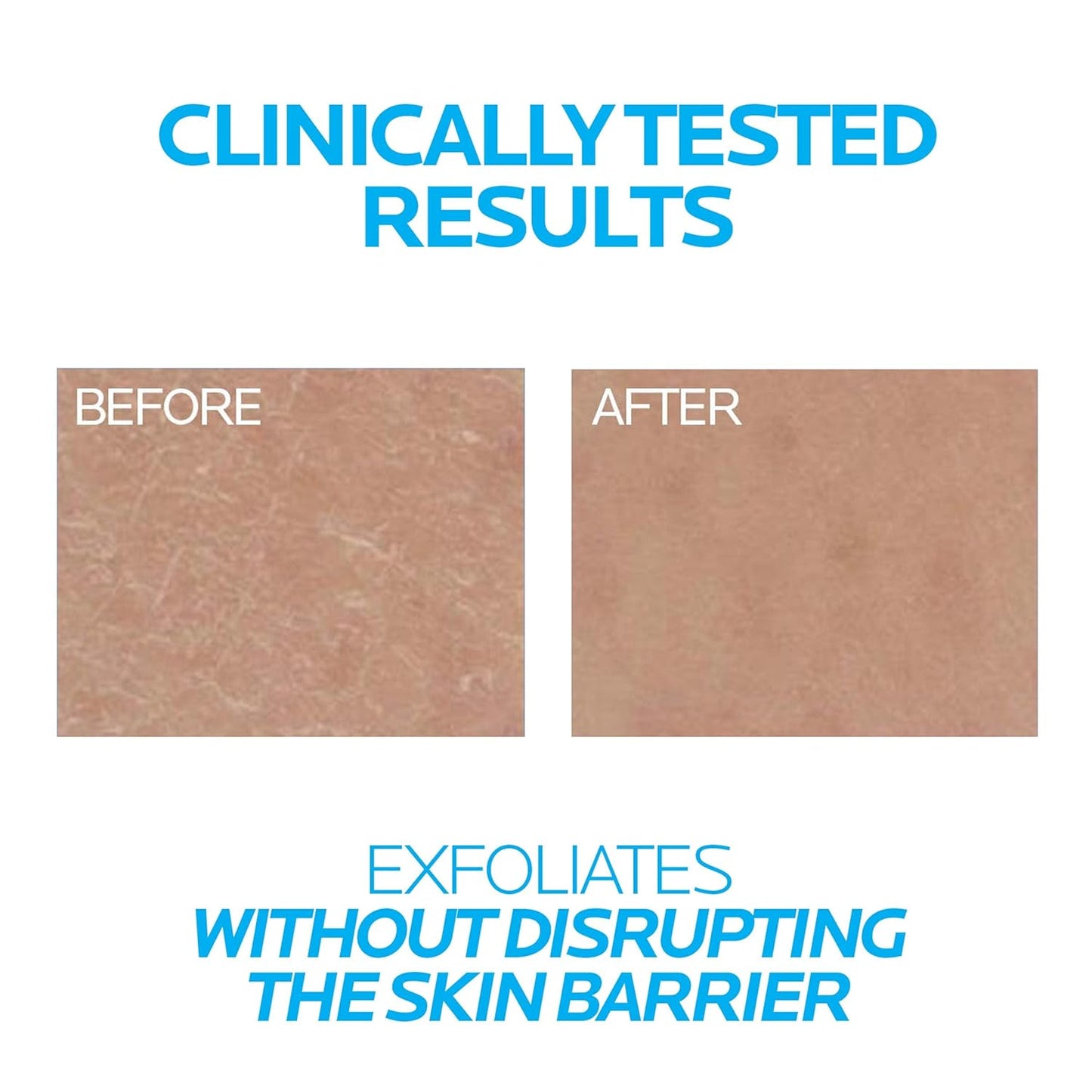 La Roche - Posay Lipikar Urea 10% Roughness Smoothing Lotion, Body Lotion For Dry Skin With 10% Urea + Shea Butter + Allantoin, Rough And Bumpy Skin Lotion, Softens & Smooths Skin With 1 Application - 7DAY'S