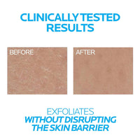 La Roche - Posay Lipikar Urea 10% Roughness Smoothing Lotion, Body Lotion For Dry Skin With 10% Urea + Shea Butter + Allantoin, Rough And Bumpy Skin Lotion, Softens & Smooths Skin With 1 Application - 7DAY'S
