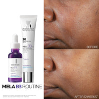 La Roche - Posay Mela B3 UV Daily Sunscreen, Face Moisturizer With SPF 30 + Anti - Aging Melasyl + 5% Niacinamide, Helps Correct & Protect From Sun Damage, Face Sunscreen With No White Cast, 40ML - 7DAY'S