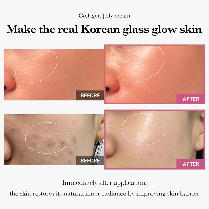 medicube Collagen Jelly Cream - Niacinamide & Freeze - Dried Hydrolyzed Collagen - Boosts skin barrier hydration & gives 24h Glow & Firmer looking skin | No artificial color, Korean skincare (3.71 fl.oz.) - 7DAY'S