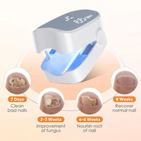 Nail Fungus Laser Treatment LED Light Device Effective Rechargeable Nail Fungus Remover Nail Fungus Cleaning Laser Device Repair Damaged Discolored Thick Fingernails - 7DAY'S