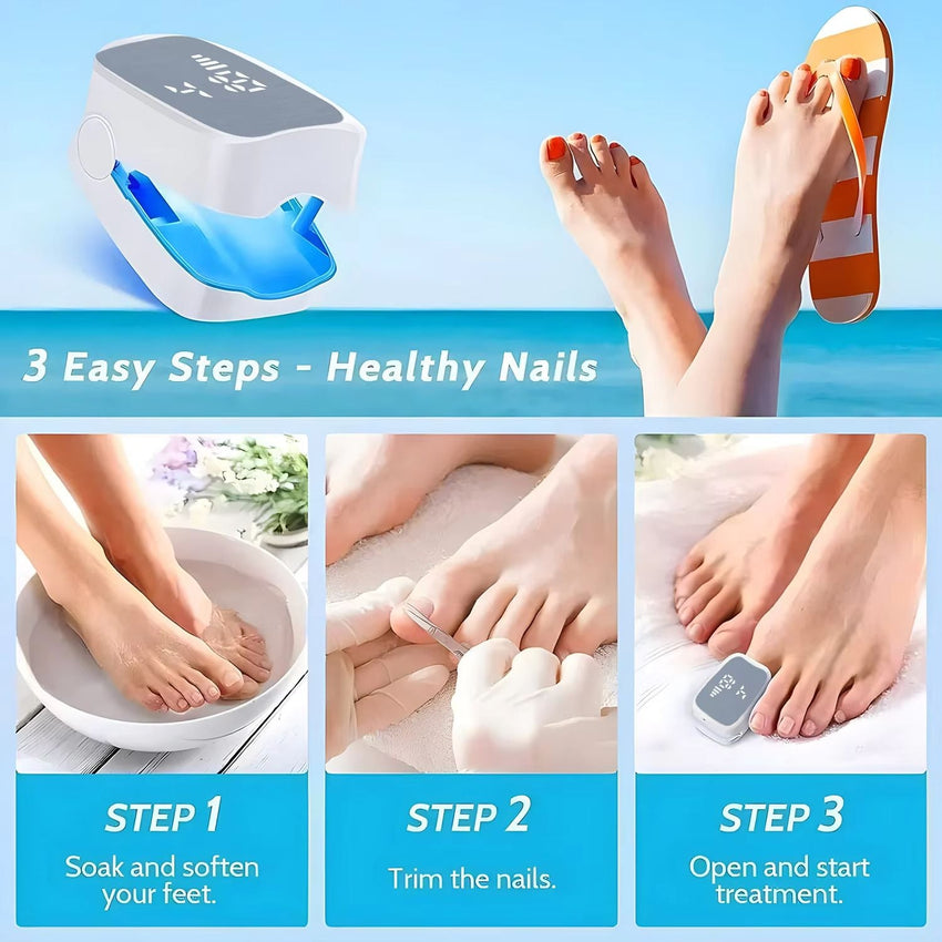 Nail Fungus Laser Treatment LED Light Device Effective Rechargeable Nail Fungus Remover Nail Fungus Cleaning Laser Device Repair Damaged Discolored Thick Fingernails - 7DAY'S