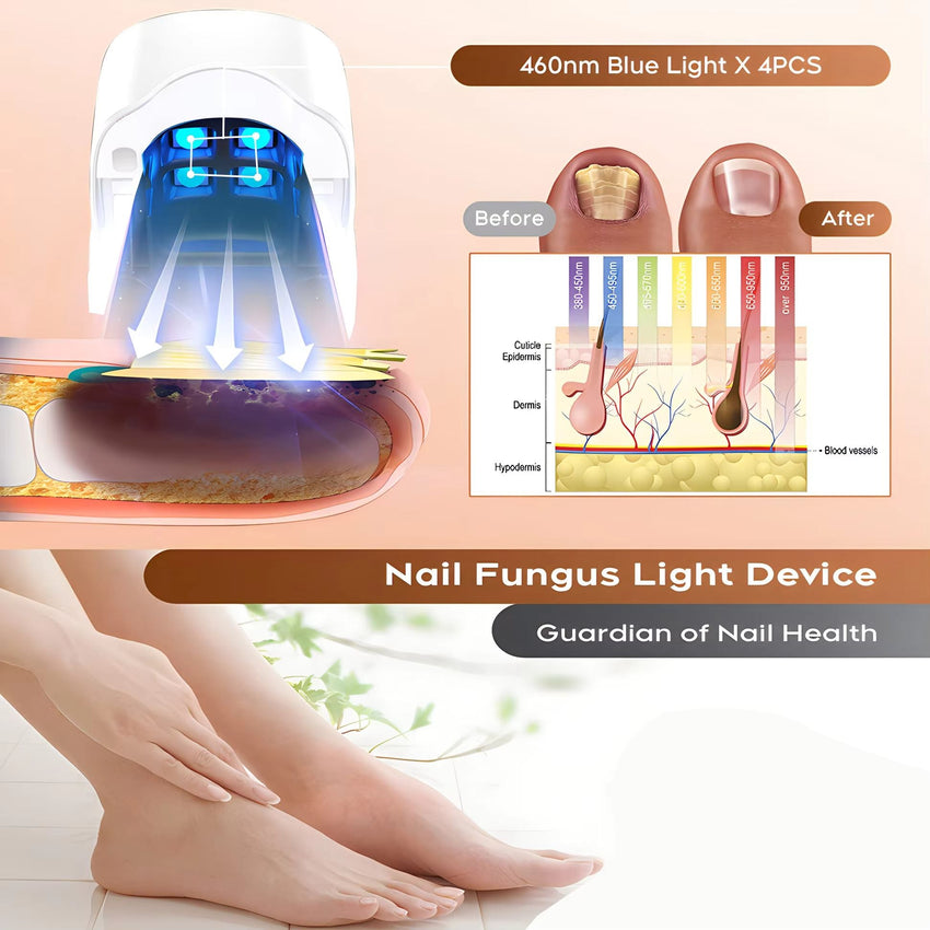 Nail Fungus Laser Treatment LED Light Device Effective Rechargeable Nail Fungus Remover Nail Fungus Cleaning Laser Device Repair Damaged Discolored Thick Fingernails - 7DAY'S