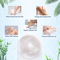 OUKEYA Urea Cream 40 Percent,Foot & Hand Cream for Dry Cracked,Urea Lotion for Feet Maximum Strength - 7DAY'S