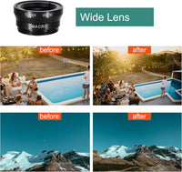 Phone Lens,by Ailun,3 in 1 Clip on 180 Degree Fish Eye Lens+0.65X Wide Angle+10X Macro Lens,Universal HD Camera Lens Kit for Mobile Phone,Cellphone,Smart Phone - 7DAY'S