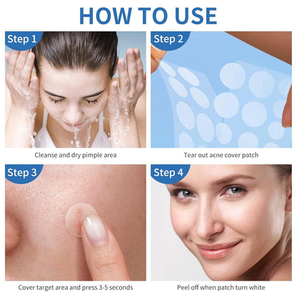 Pimple Patches for Face, 4 Size 300 Counts Acne Patches, Hydrocolloid Patches for Covering Zits and Blemishes, Spot Stickers with Salicylic Acid, Tea Tree Oil & Calendula Oil - 7DAY'S