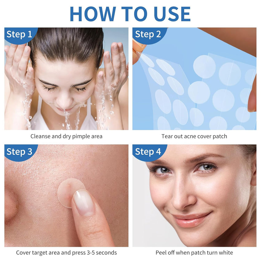 Pimple Patches for Face, 4 Size 300 Counts Acne Patches, Hydrocolloid Patches for Covering Zits and Blemishes, Spot Stickers with Salicylic Acid, Tea Tree Oil & Calendula Oil - 7DAY'S