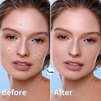 Pimple Patches for Face, 4 Size 300 Counts Acne Patches, Hydrocolloid Patches for Covering Zits and Blemishes, Spot Stickers with Salicylic Acid, Tea Tree Oil & Calendula Oil - 7DAY'S