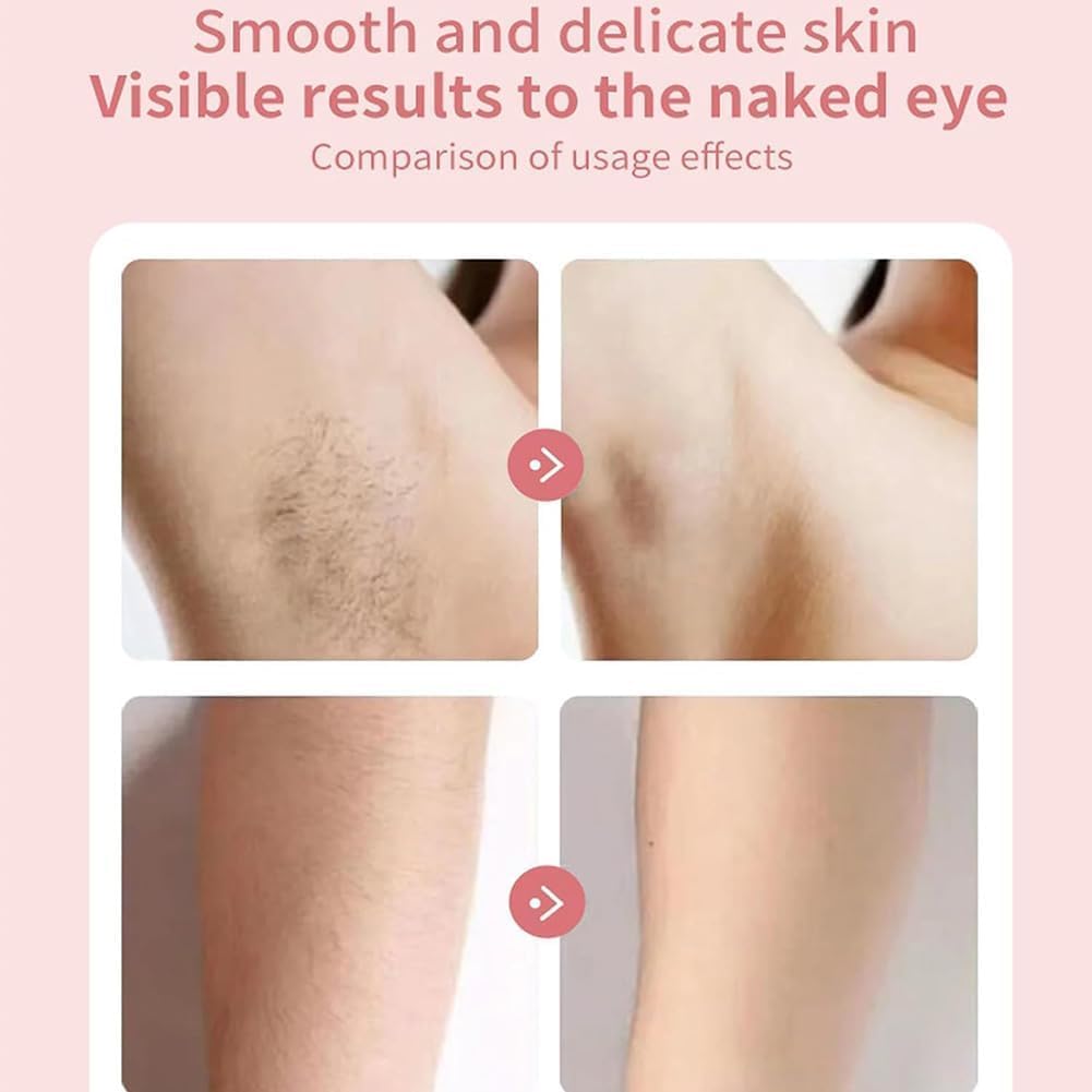 Rayzo Smooth Shave, Body Shaver Women, Dermwave Trimmer 2.0, VantiqueShaver, Razyo Razor, Comfort 2 in 1 Electric Lady Shaver, 2 In1 Wet & Dry (Blue) - 7DAY'S