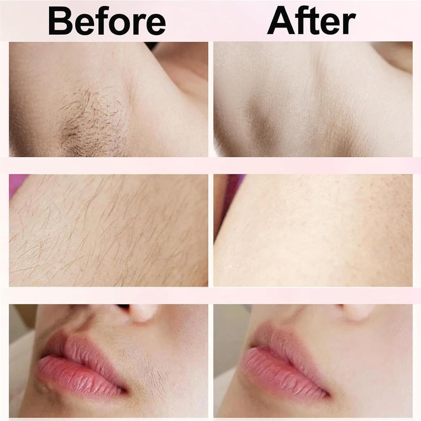 Serined Shaver, Serinedshave - 2 - in - 1 Women's Body Shaver, Beauty Bloom Electric Razor, 2 - in - 1 Women's BodyShaver, Smoovi 2.0 BikiniShaver, Dual Head Wet & Dry, for Pubic Hair (Pink) - 7DAY'S