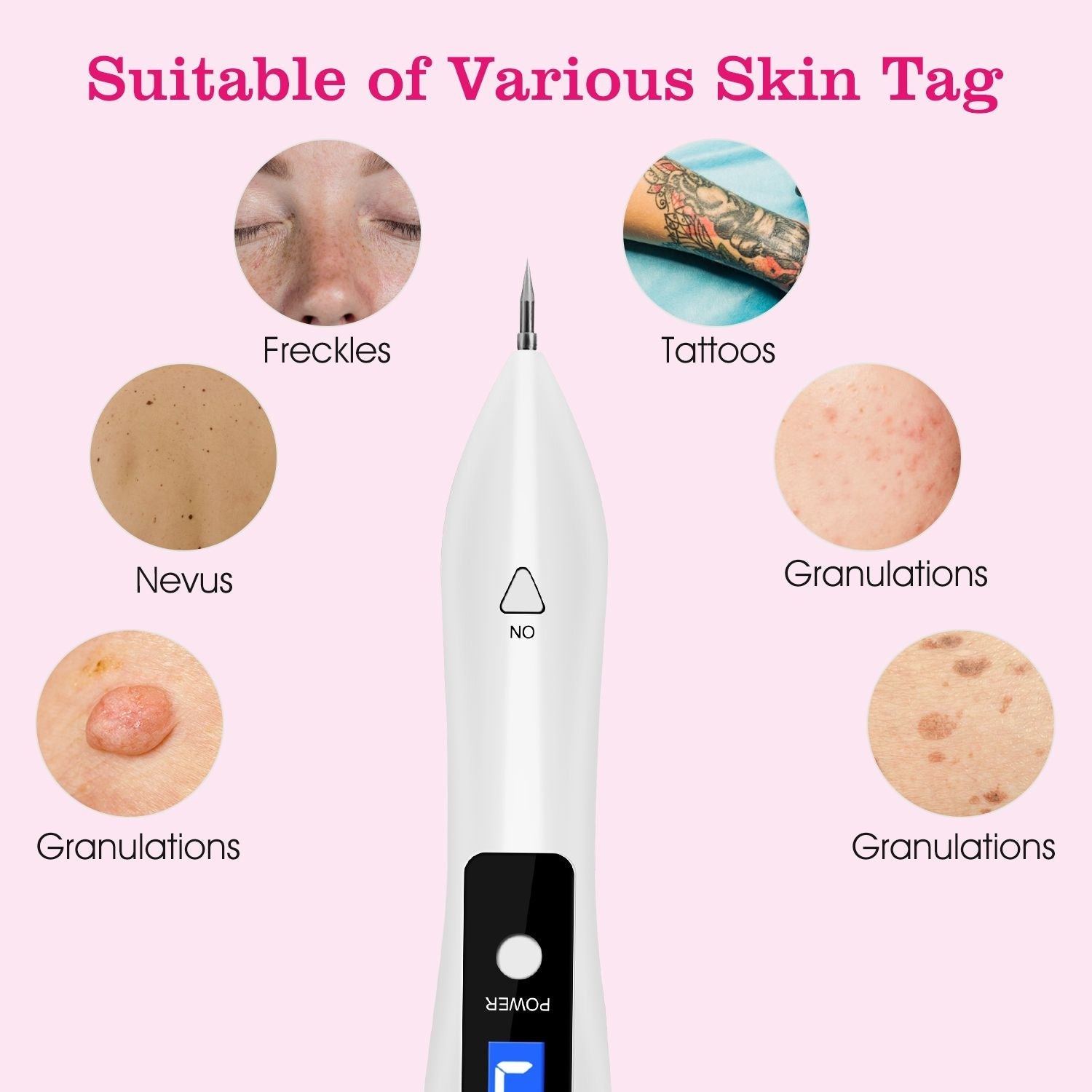Skin Tag Repair Kit Portable Beauty Equipment Multi - Level with Home Usage USB Charging LCD Level Adjustable 6 Replaceable Needles - 7DAY'S
