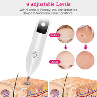 Skin Tag Repair Kit Portable Beauty Equipment Multi - Level with Home Usage USB Charging LCD Level Adjustable 6 Replaceable Needles - 7DAY'S