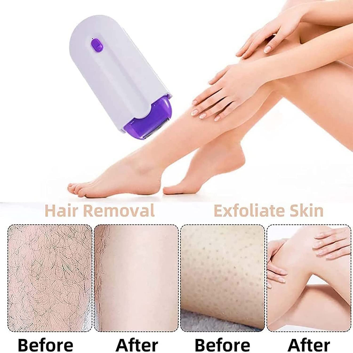 Smartshavy - Smartshavy Hair Eraser,Smart Shavey,Sillky Smoth Hair Eraser for Women,Smart Shavey Laser Hair Removal,Smart Shavy Unisex Hair Eraser,Hair Remover,Lumishave Hair Remover (1SET) - 7DAY'S