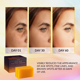 VALITIC Kojic Acid Dark Spot Remover Soap Bars with Vitamin C, Retinol, Collagen, Turmeric - Original Japanese Complex Infused with Hyaluronic Acid, Vitamin E, Shea Butter, Castile Olive Oil (2 Pack) - 7DAY'S